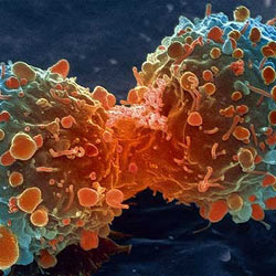 Teorie o vzniku a léčení rakoviny II.
